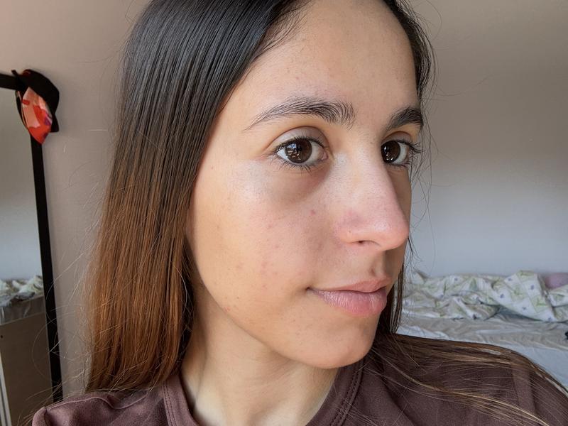 Antes