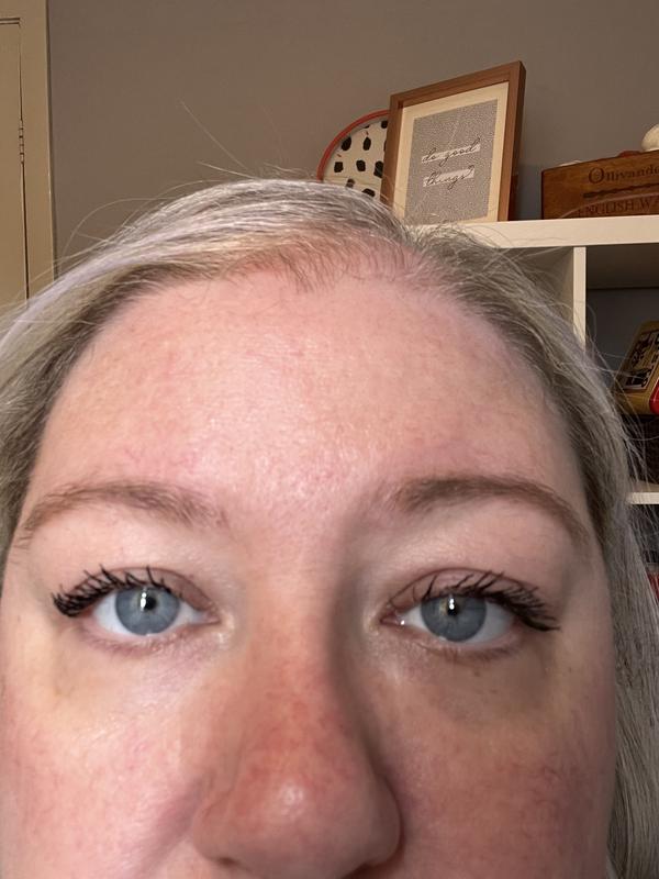 Before and after