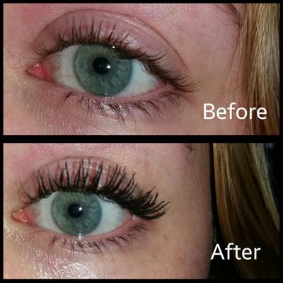 Before and after