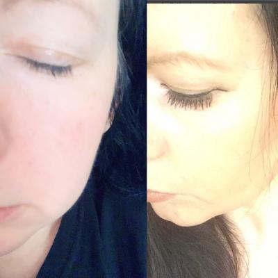 Befit and after