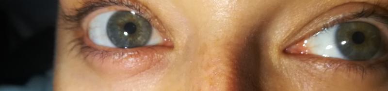 Bad allergy after I used this mascara