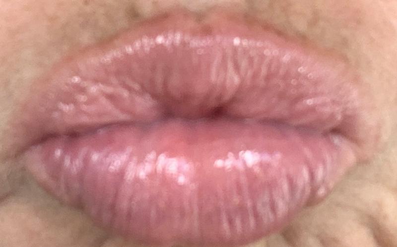 Pucker up