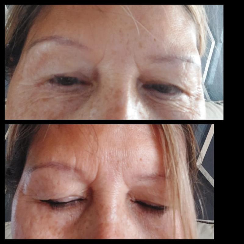 Before and After - with no other makeup