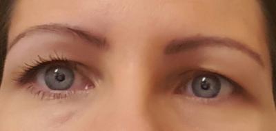 before and after