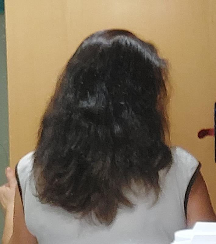 melena sin apelmazar 36h despues