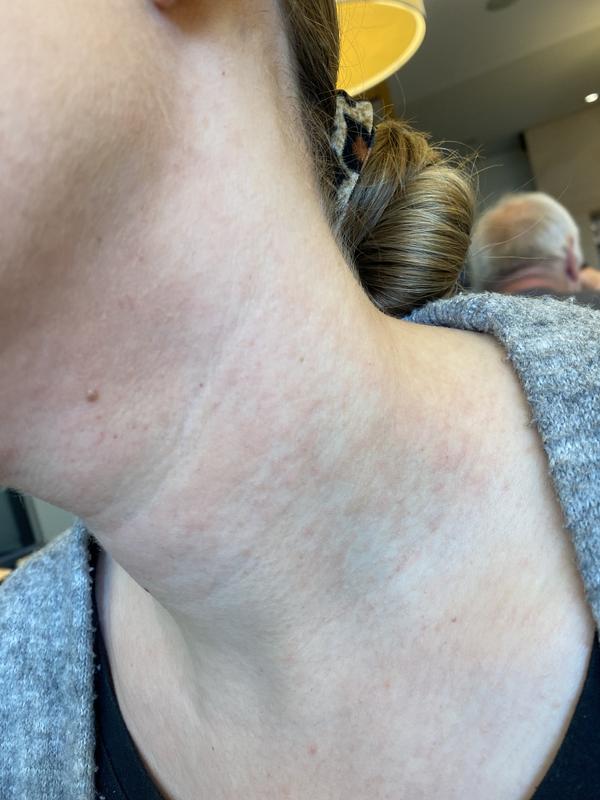 Bewertung zu Foto 1.