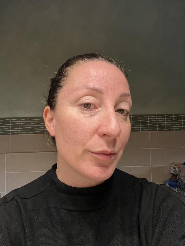 La foto con i capelli raccolti sono dopo 3 settimane di trattamento mentre