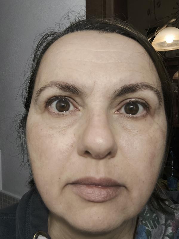 Il prima e dopo 1 settimana di utilizzo
