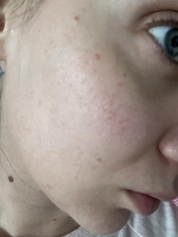Prima e dopo in una settimana