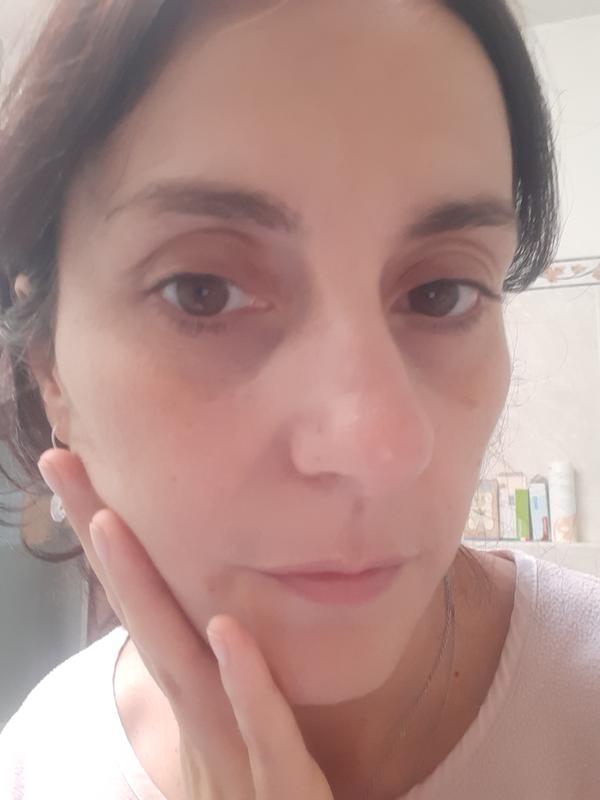 Prima e dopo