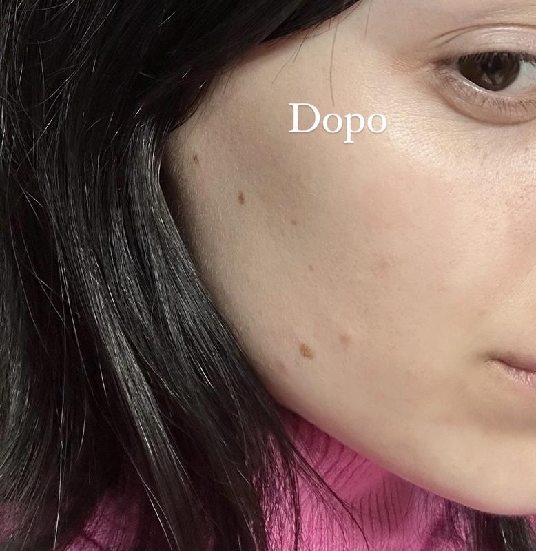 Prima e dopo