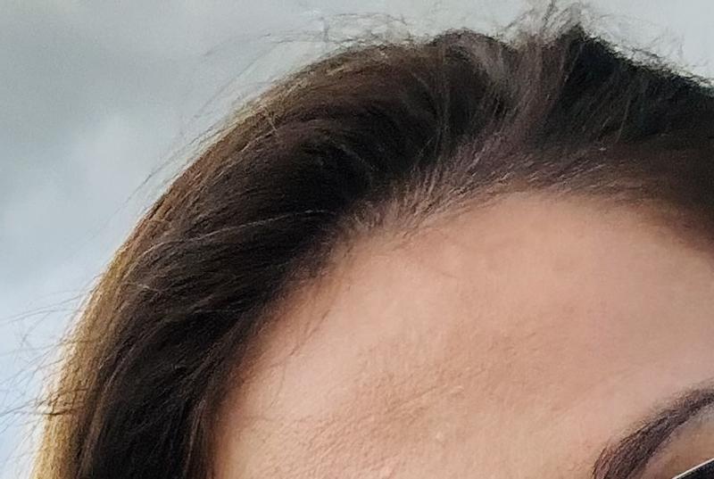 Dopo