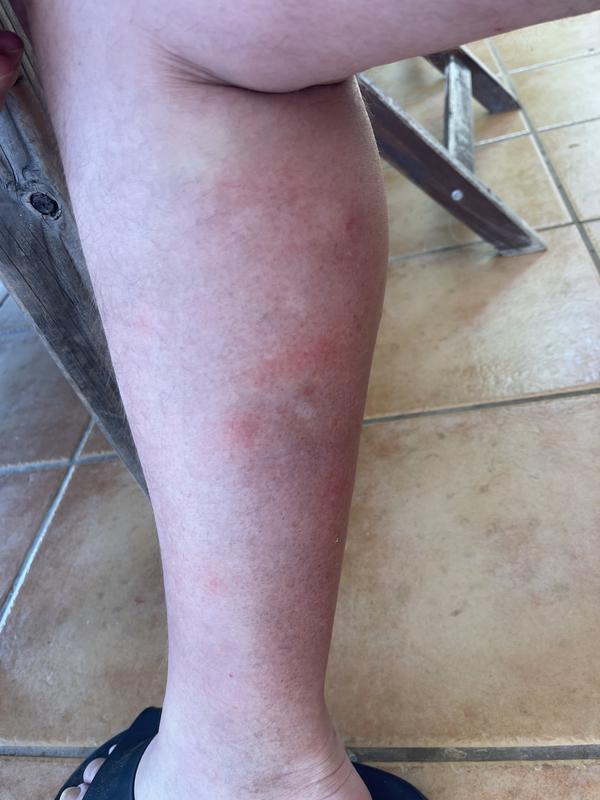 Abra o modal de avaliação 1 de 1