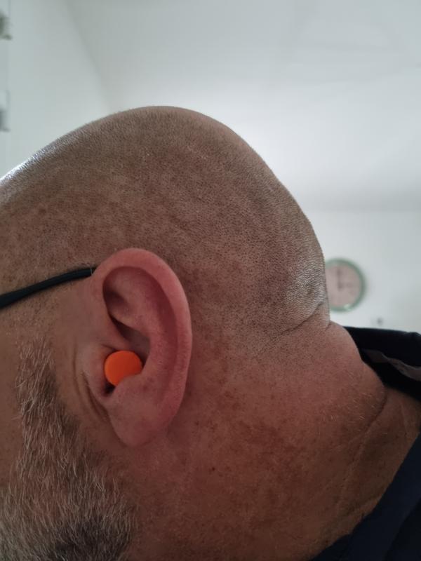 Ouvrir la fenêtre modale de l'avis 1 sur 1