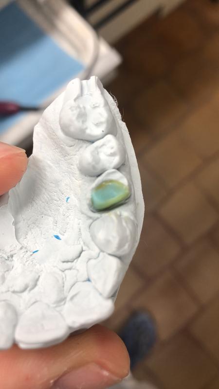 Revisione aperta modale 1 su 2