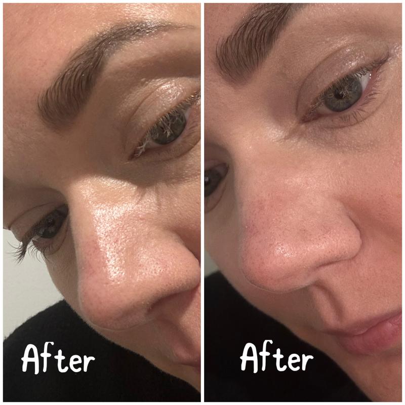 Concealer on nose, with primer and without