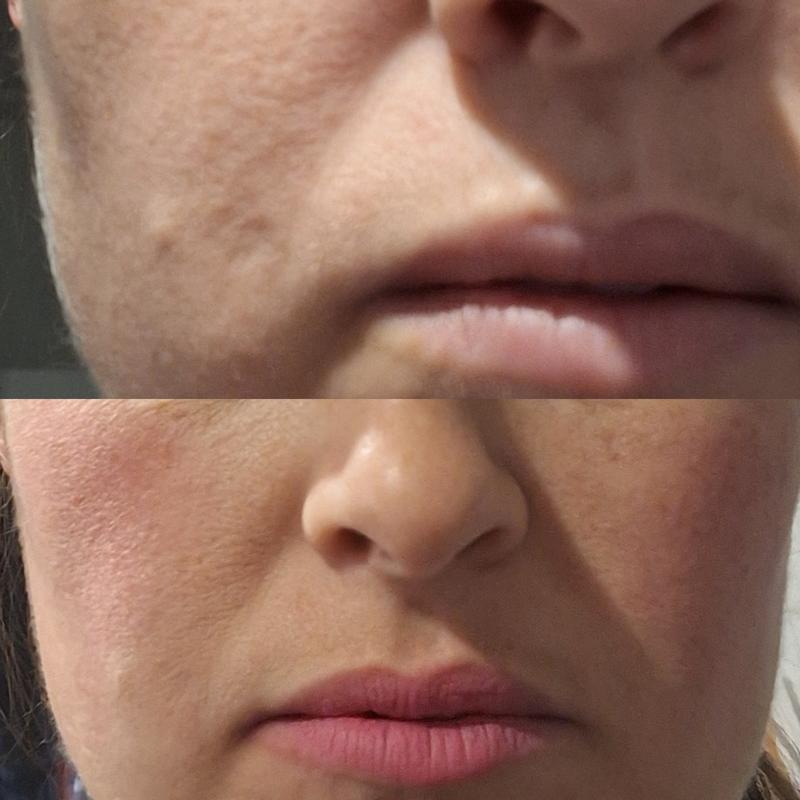 Before and after