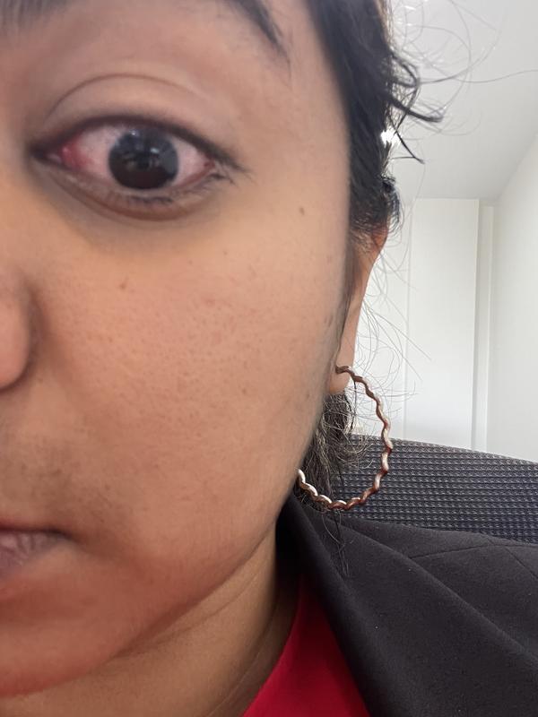 Eye infection from the eye liner