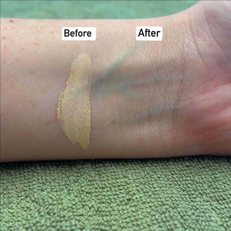 Concealer coverage on freckled skin