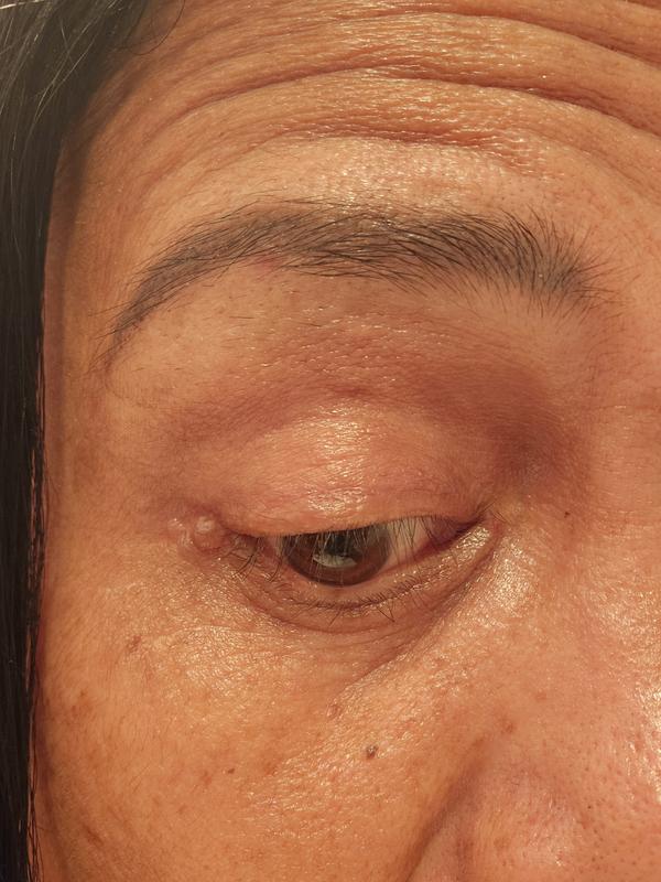 Before