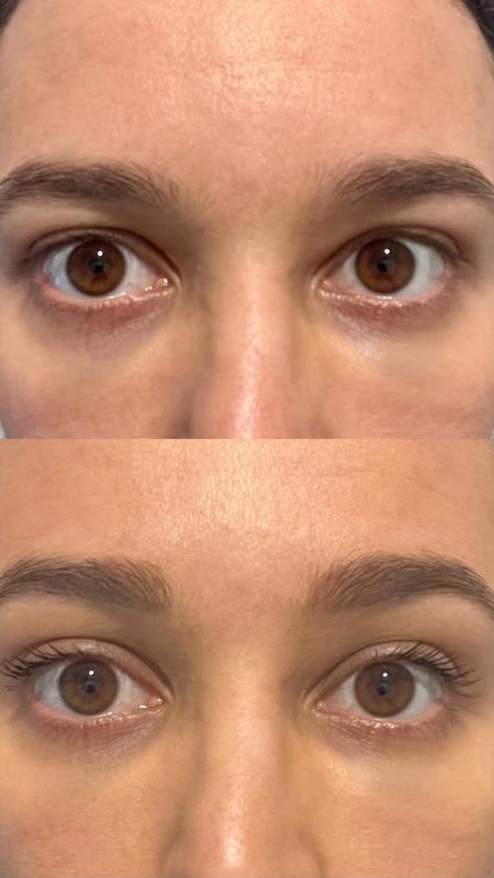 Before and after