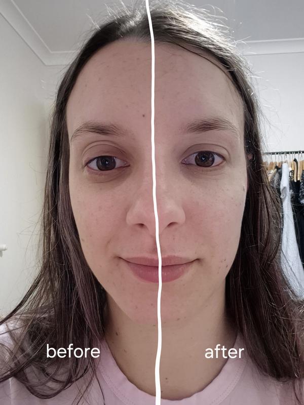 Before and after