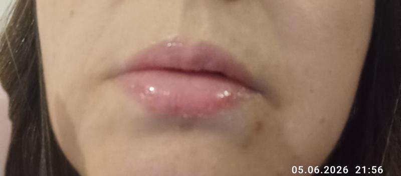 Avis sur la photo 3.