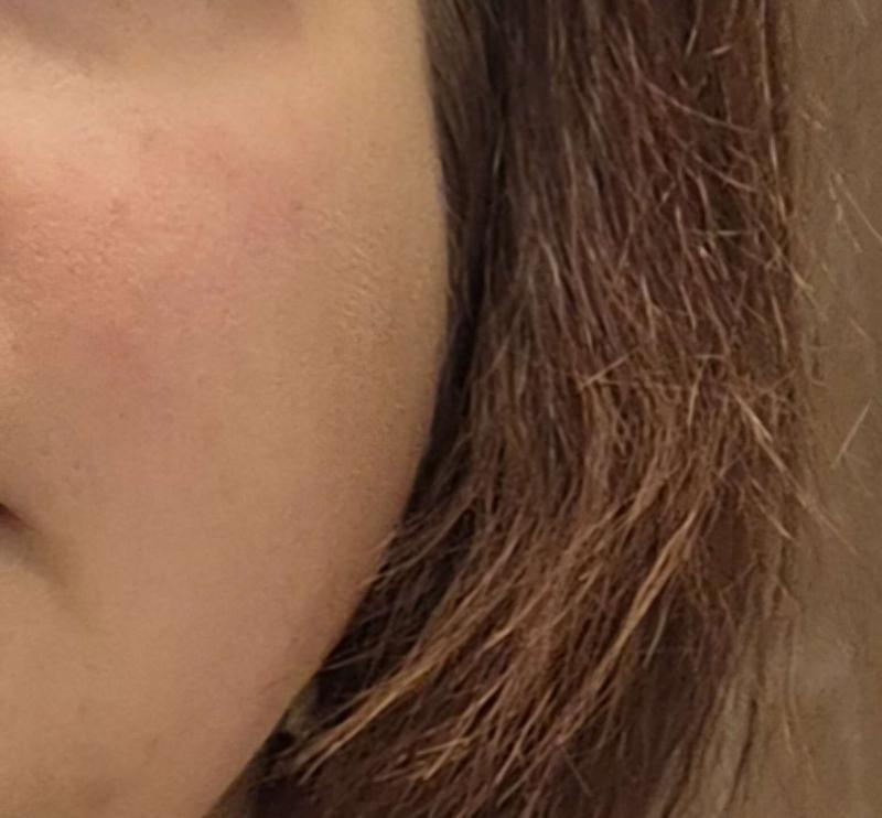 Bewertung von Foto 4.