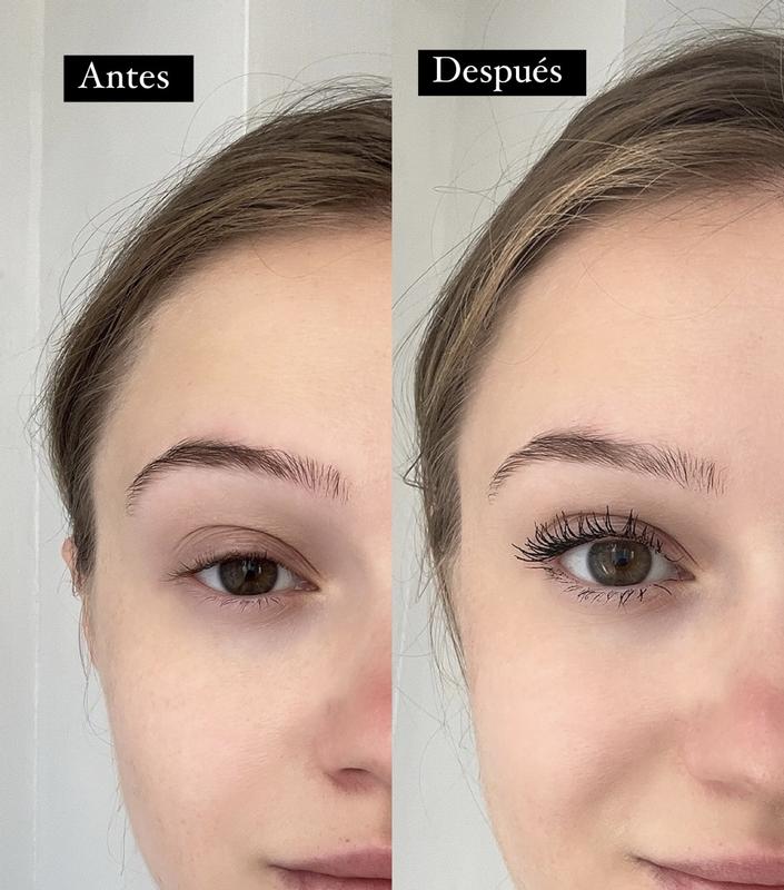 Antes/ Después