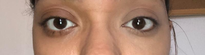 A la izquierda sin corrector y a la derecha con el Corrector Borrador de Maybelline