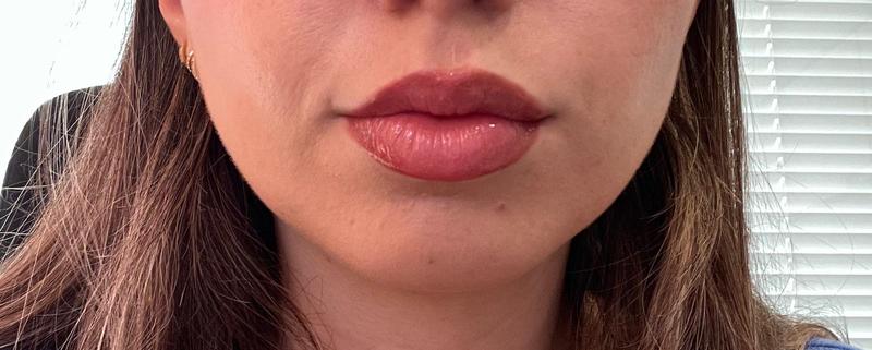 labial puesto