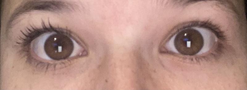 Un ojo con la mascara y el otro sin ella