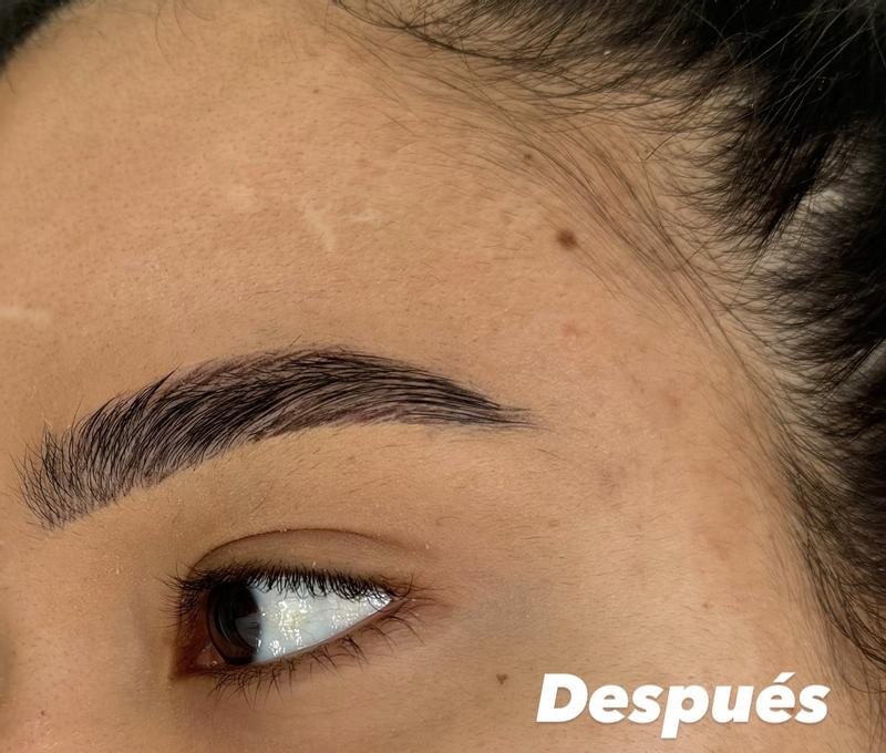 Después de la aplicacion