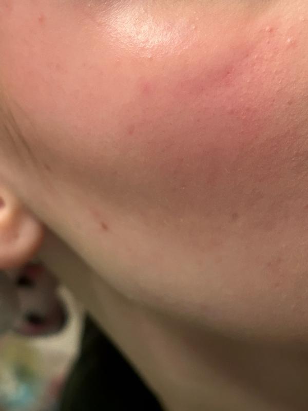 Beoordeling foto 1.