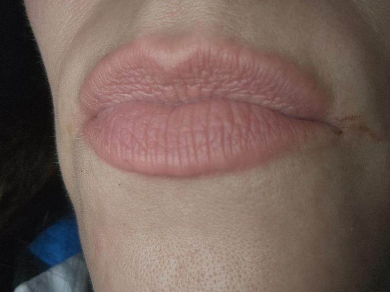 Beoordeling foto 1.