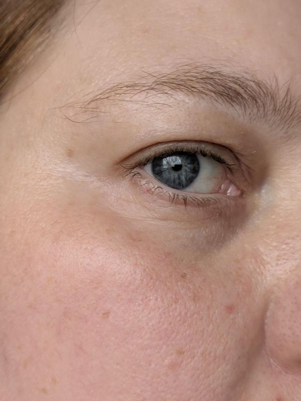 Beoordeling foto 2.