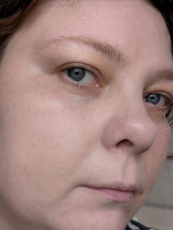 Beoordeling foto 4.