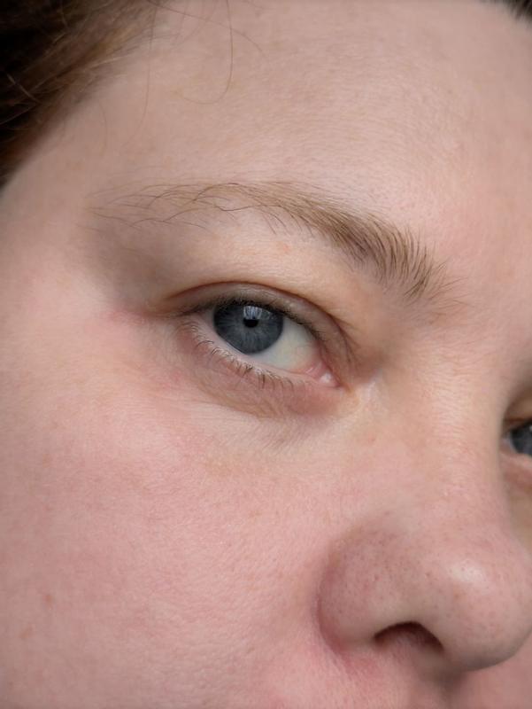 Beoordeling foto 5.