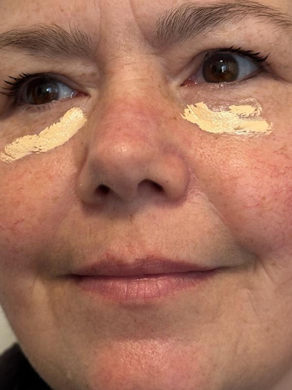 Beoordeling foto 1.