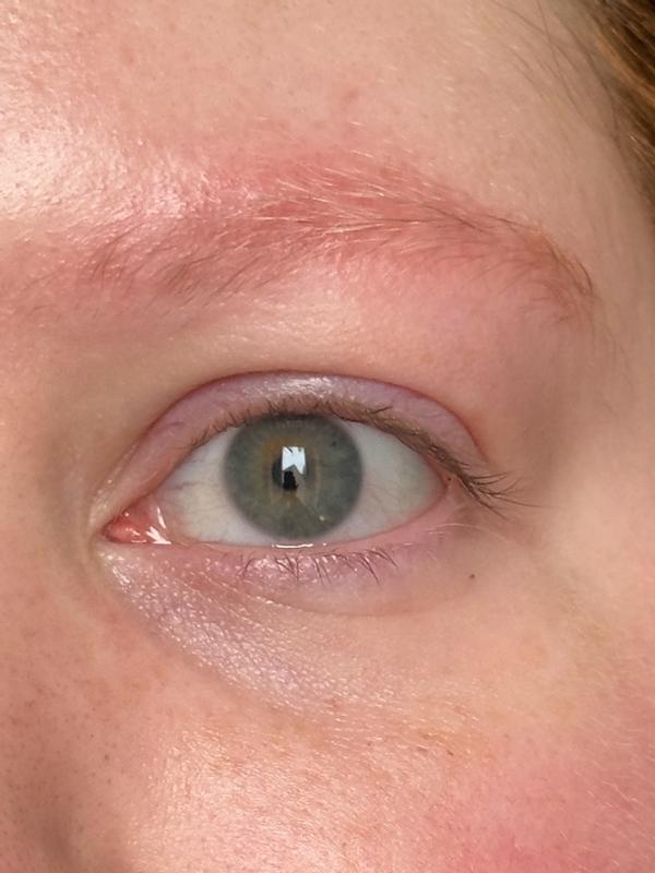 Beoordeling foto 1.
