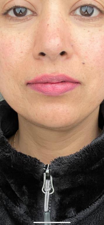 Review Thumbnail Image 1 238560927