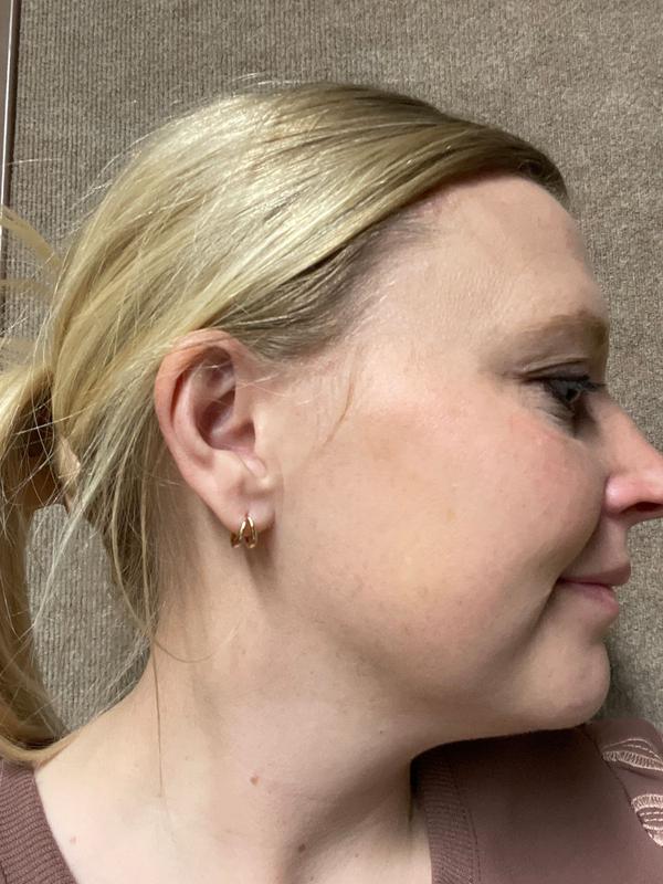 Review Thumbnail Image 0 371785225