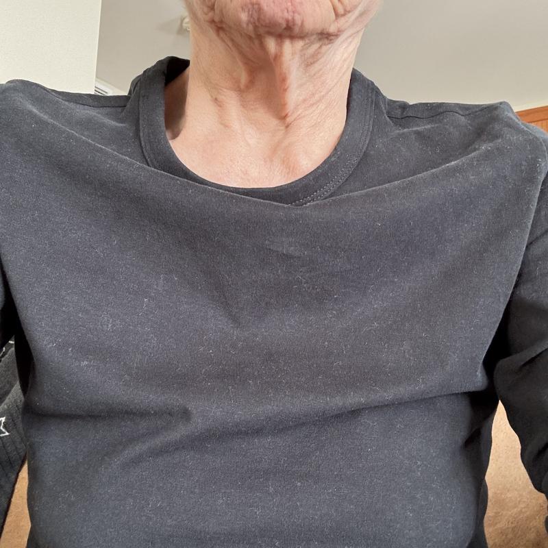 Front of the shirt, excess material imperfection