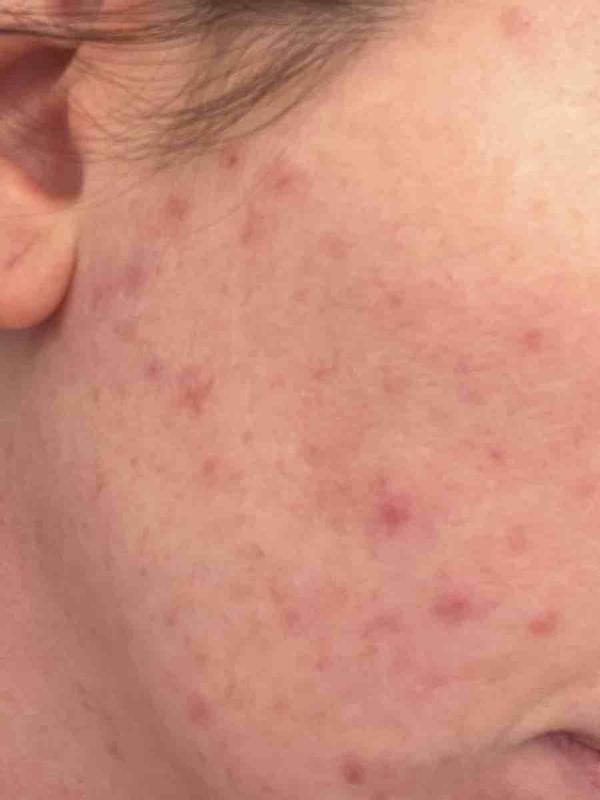 Review Thumbnail Image 0 245091443