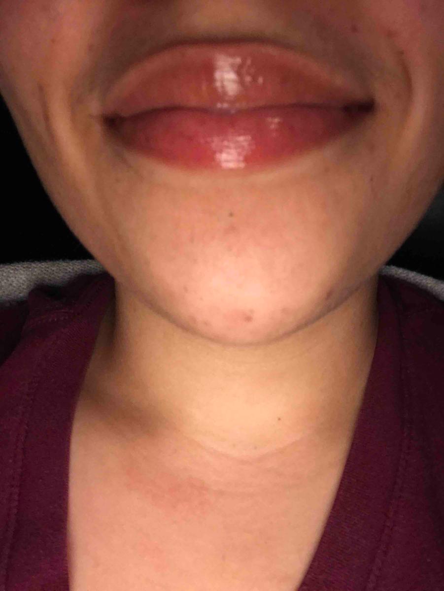 Review Thumbnail Image 0 196557994