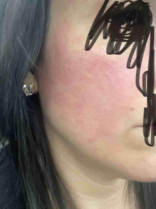 Review Thumbnail Image 0 214804330