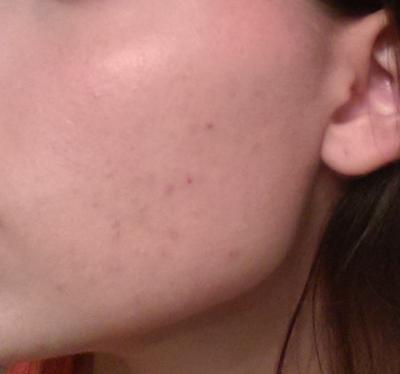 Review Thumbnail Image 0 124770511