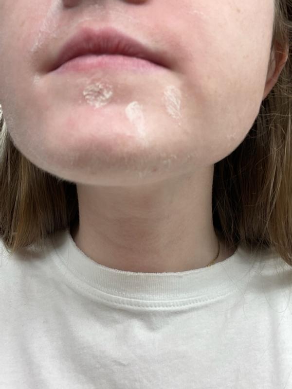 Review Thumbnail Image 1 220652632