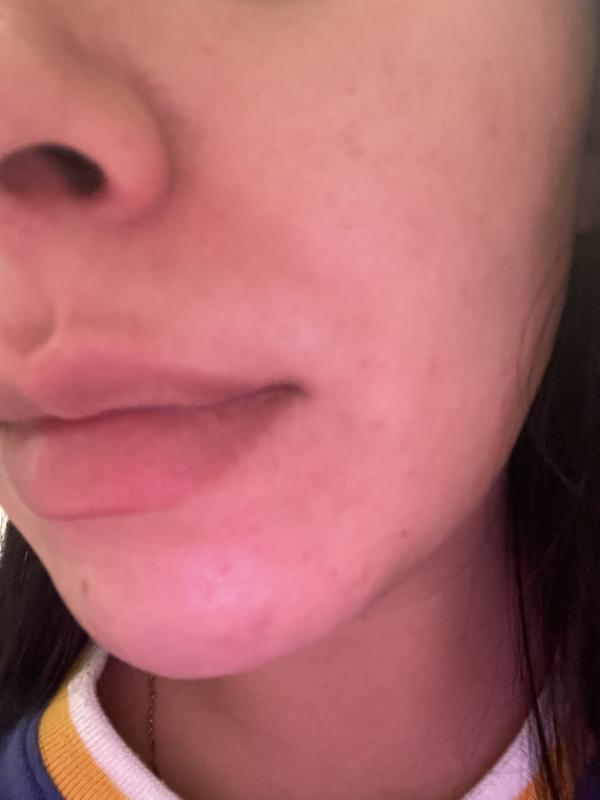 Review Thumbnail Image 2 226779400