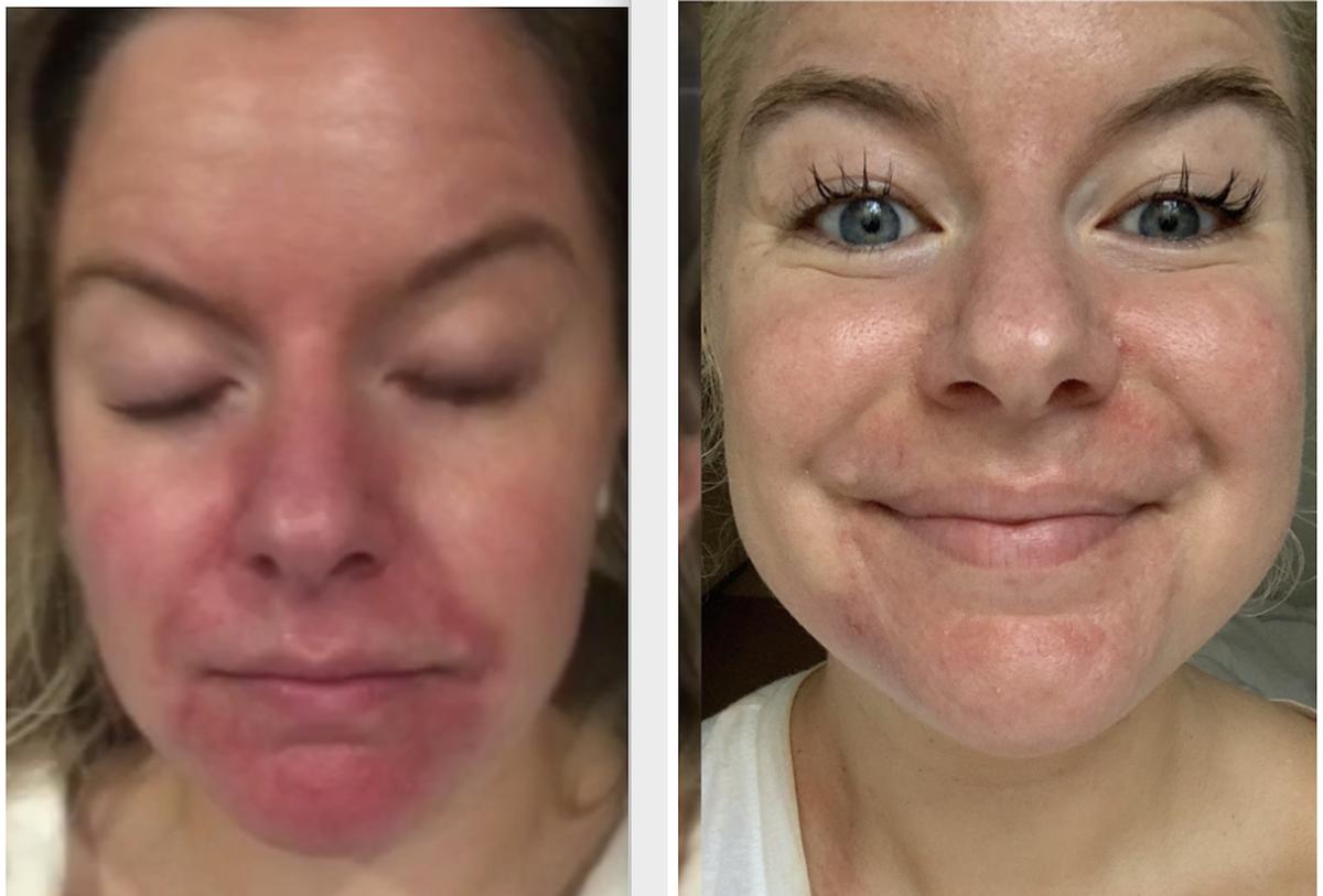 Review Thumbnail Image 0 205137731